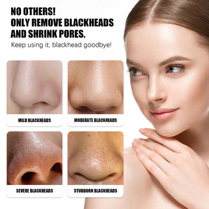 OUHOE Blackhead Peeling Nose Mask Deep Cleansing, Blackhead Acne, Pore Tightening, Strawberry Nose Mask - Osacean Sky Logistics