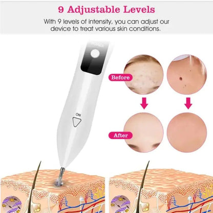 Skin Tag Repair Kit Portable Beauty Equipment Multi - Level With Home Usage USB Charging LCD Level Adjustable 6 Replaceable Needles - Osacean Sky Logistics